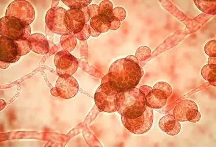 La C. auris es el hongo más detectado en las unidades de terapia intensiva en el mundo