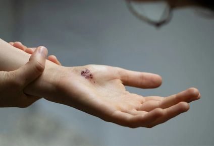 la bacteria come carne pone en alerta a europa: piden extremar las precauciones ante el aumento del riesgo