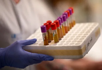 brote en treinta y tres hizo que preocupacion por el coronavirus volviera a aumentar