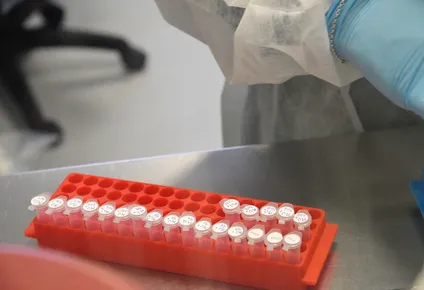 los nuevos brotes del virus y como esta la situacion sanitaria en el pais