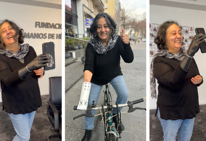 perdio su mano en un accidente pero nunca su fuerza por salir adelante: una nueva historia de manos de heroes